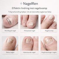 NagelRen – För friskare och klarare naglar hemma